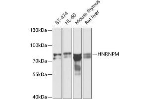 Western blot analysis of extracts of various cell lines, using HNRNPM antibody (ABIN6128031, ABIN6141919, ABIN6141920 and ABIN6222681) at 1:1000 dilution. (HNRNPM anticorps  (AA 491-730))