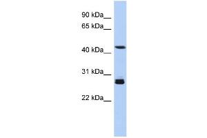 WB Suggested Anti-SYT9 Antibody Titration: 0. (SYT9 anticorps  (Middle Region))