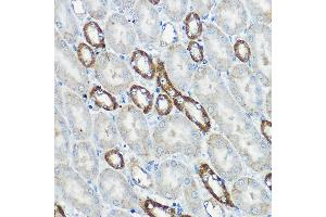 Immunohistochemistry of paraffin-embedded mouse kidney using IP6K1 Rabbit pAb (ABIN6131922, ABIN6142500, ABIN6142501 and ABIN6215821) at dilution of 1:100 (40x lens). (IP6K1 anticorps  (AA 1-220))