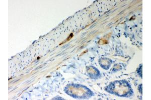 Anti- ATP5H Picoband antibody,IHC(P) IHC(P): Rat Intestine Tissue