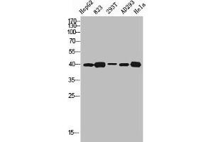 Western blot analysis of HEPG2 823 293T AD293 HELA using SR-1D antibody. (5HT1D anticorps  (Internal Region))