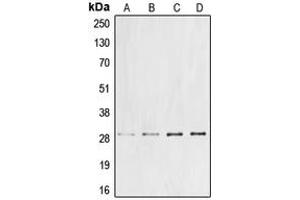 Western blot analysis of Cyclin G1 expression in DLD (A), Jurkat (B), mouse liver (C), rat liver (D) whole cell lysates. (Cyclin G1 anticorps  (Center))