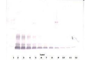 Image no. 3 for anti-PDGF-BB Homodimer antibody (ABIN465590) (PDGF-BB Homodimer anticorps)