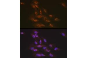 Immunofluorescence analysis of U-2 OS cells using Transportin 3 (Transportin 3 (TNPO3)) Rabbit mAb (ABIN7270971) at dilution of 1:100 (40x lens).