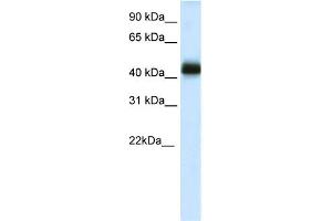 WB Suggested Anti-NKX2-4 Antibody Titration:  0. (NK2 Homeobox 4 anticorps  (C-Term))