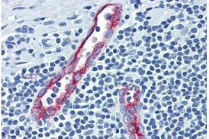 Human Tonsil (formalin-fixed, paraffin-embedded) stained with SELP antibody ABIN462342 followed by biotinylated anti-mouse IgG secondary antibody ABIN481714, alkaline phosphatase-streptavidin and chromogen. (P-Selectin anticorps)