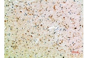 Immunohistochemical analysis of paraffin-embedded human-brain, antibody was diluted at 1:200 (FCGR3A anticorps)