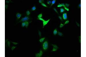 Immunofluorescence staining of HepG2 cells with ABIN7154014 at 1:133, counter-stained with DAPI. (GLS2 anticorps  (AA 15-602))