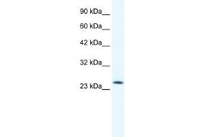 WB Suggested Anti-TCF7 Antibody Titration:  0. (TCF7 anticorps  (N-Term))