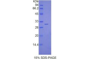 SDS-PAGE analysis of Mouse IL17RD Protein. (IL17RD Protéine)