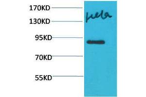 Western Blotting (WB) image for anti-Signal Transducer and Activator of Transcription 4 (STAT4) antibody (ABIN3181592) (STAT4 anticorps)