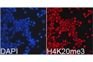 Immunofluorescence analysis of 293T cells using TriMethyl-Histone H4-K20 antibody.