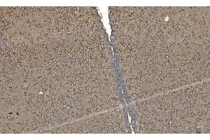 IHC analysis of FABP-1/GOT2 using anti-FABP-1/GOT2 antibody (ABIN7601426). (GOT2 anticorps  (AA 35-430))