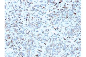 Formalin-fixed, paraffin-embedded human Kidney stained with C1QA Mouse Monoclonal Antibody (C1QA/2952).