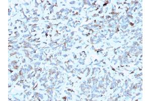Formalin-fixed, paraffin-embedded human Kidney stained with C1QA Mouse Monoclonal Antibody (C1QA/2952). (C1QA anticorps  (AA 104-237))