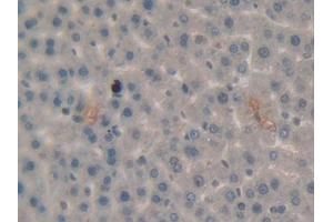 IHC-P analysis of Rat Liver Tissue, with DAB staining. (PLG anticorps  (AA 191-433))