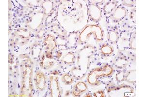 Formalin-fixed and paraffin embedded rat kidney labeled with Rabbit Anti PAI-1 Polyclonal Antibody, Unconjugated (ABIN733223) at 1:200 followed by conjugation to the secondary antibody and DAB staining (PAI1 anticorps  (AA 301-402))
