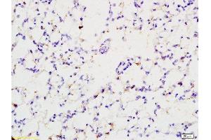 Formalin-fixed and paraffin embedded rat lung tissue labeled with Anti-EPOR Polyclonal Antibody , Unconjugated at 1:200 followed by conjugation to the secondary antibody and DAB staining (EPOR anticorps  (AA 301-450))