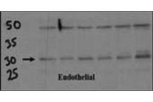 Endothelial cell lysate transferred to membrane was incubated with DSCR1 antibody at a 1:500 dilution.