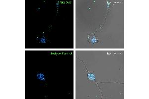 Live Cell Imaging (LCI) image for anti-Glutamate Receptor, Ionotropic, N-Methyl D-Aspartate 1 (GRIN1) (Extracellular), (N-Term) antibody (ABIN7886359)