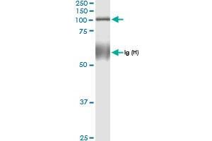 Immunoprecipitation of TUBGCP2 transfected lysate using anti-TUBGCP2 MaxPab rabbit polyclonal antibody and Protein A Magnetic Bead , and immunoblotted with TUBGCP2 MaxPab rabbit polyclonal antibody (D01) .