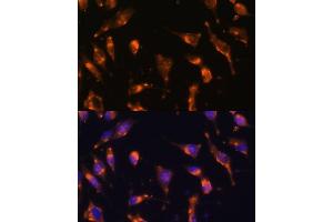 Immunofluorescence analysis of L929 cells using Somatostatin Receptor 2 (SSTR2) Polyclonal Antibody (ABIN7270493) at dilution of 1:100 (40x lens).