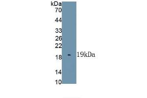 Detection of Recombinant IL1F9, Human using Polyclonal Antibody to Interleukin 1 Family, Member 9 (IL1F9) (IL1F9 anticorps  (AA 1-162))