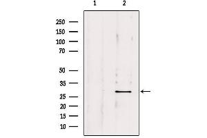 Western blot analysis of extracts from mouse brain, using OTUB2 Antibody.
