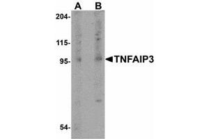 Image no. 1 for anti-Tumor Necrosis Factor, alpha-Induced Protein 3 (TNFAIP3) (Internal Region) antibody (ABIN478080) (TNFAIP3 anticorps  (Internal Region))