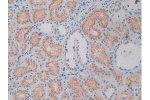 DAB staining on IHC-P; Samples: Human Kidney Tissue (APOL1 anticorps  (AA 1-238))