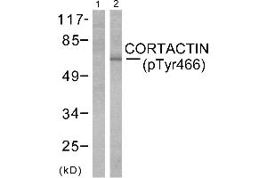 Western blot analysis of extracts from cos-7cells using Cortactin (phospho-Tyr466) antibody (Line 1 and 2). (Cortactin anticorps  (pTyr466))