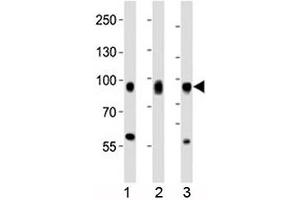 Western blot analysis of lysate from 1) HeLa, 2) PC3, and 3) HT-1080 cell line using CD44 antibody at 1:1000. (CD44 anticorps  (AA 688-722))