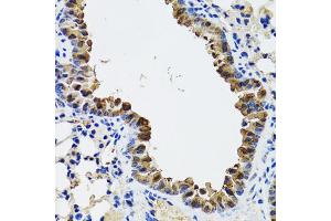 Immunohistochemistry of paraffin-embedded mouse lung using ESD antibody (ABIN5973666) at dilution of 1/100 (40x lens).