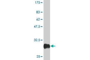 Western Blot detection against Immunogen (31.