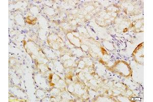 Formalin-fixed and paraffin embedded mouse kidney tissue labeled with Anti-MCKD2/UMOD Polyclonal Antibody, Unconjugated  at 1:200 followed by conjugation to the secondary antibody and DAB staining (Uromodulin anticorps  (AA 351-450))