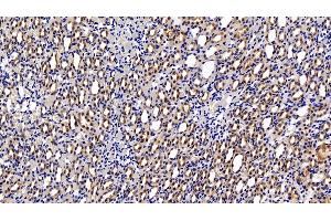 Detection of HIF1a in Rat Kidney Tissue using Polyclonal Antibody to Hypoxia Inducible Factor 1 Alpha (HIF1a)