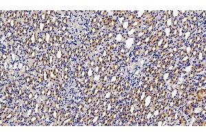 Detection of HIF1a in Rat Kidney Tissue using Polyclonal Antibody to Hypoxia Inducible Factor 1 Alpha (HIF1a) (HIF1A anticorps  (AA 216-336))
