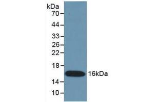 Detection of Recombinant IFNg, Mouse using Monoclonal Antibody to Interferon Gamma (IFNg) (Interferon gamma anticorps  (AA 23-155))