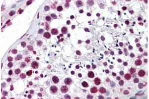 Human Testis: Formalin-Fixed, Paraffin-Embedded (FFPE) (Aryl Hydrocarbon Receptor anticorps  (AA 279-376))