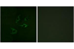 Immunofluorescence analysis of A549 cells, using CBL (Ab-774) Antibody. (CBL anticorps  (AA 740-789))