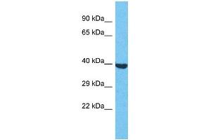 Western Blotting (WB) image for anti-Olfactory Receptor, Family 2, Subfamily S, Member 2 (OR2S2) (C-Term) antibody (ABIN2791727) (OR2S2 anticorps  (C-Term))