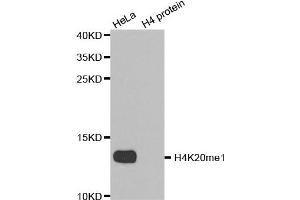 Western blot analysis of extracts of HeLa cell line and H4 protein expressed in E.