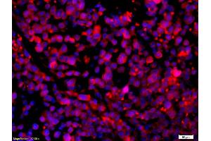 Formalin-fixed and paraffin-embedded mouse intestine carcinoma with Anti-CCR5/CD195 Polyclonal Antibody, Unconjugated (ABIN741375) 1:200, overnight at 4°C, The secondary antibody was Goat Anti-Rabbit IgG, Cy3 conjugated used at 1:200 dilution for 40 minutes at 37°C.