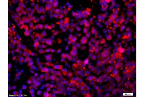Formalin-fixed and paraffin-embedded mouse intestine carcinoma with Anti-CCR5/CD195 Polyclonal Antibody, Unconjugated (ABIN741375) 1:200, overnight at 4°C, The secondary antibody was Goat Anti-Rabbit IgG, Cy3 conjugated used at 1:200 dilution for 40 minutes at 37°C. (CCR5 anticorps  (AA 201-300))