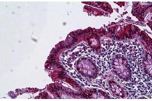 Human Colon, Epithelium: Formalin-Fixed, Paraffin-Embedded (FFPE) (Galectin 3 anticorps  (AA 141-190))