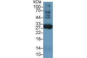 Western blot analysis of Rat Blood Cells lysate, using Rat TF Antibody (1 µg/ml) and HRP-conjugated Goat Anti-Rabbit antibody ( (Tissue factor anticorps  (AA 30-252))