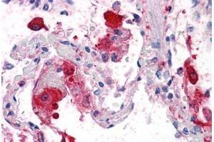 Human Lung: Formalin-Fixed, Paraffin-Embedded (FFPE)