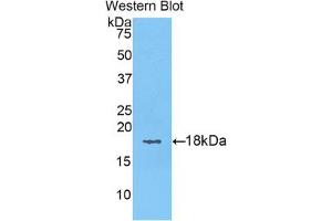 Western blot analysis of the recombinant protein. (KRT6A anticorps  (AA 323-461))