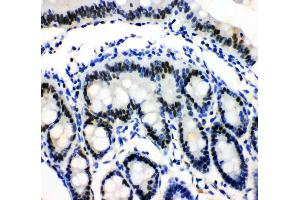 Anti-MCM3 antibody, IHC(P) IHC(P): Rat Intestine Tissue