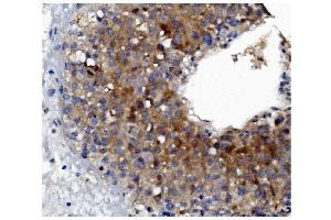 IHC analysis of GSDMD using anti-GSDMD antibody (ABIN7599432). (GSDMD anticorps  (AA 1-484))